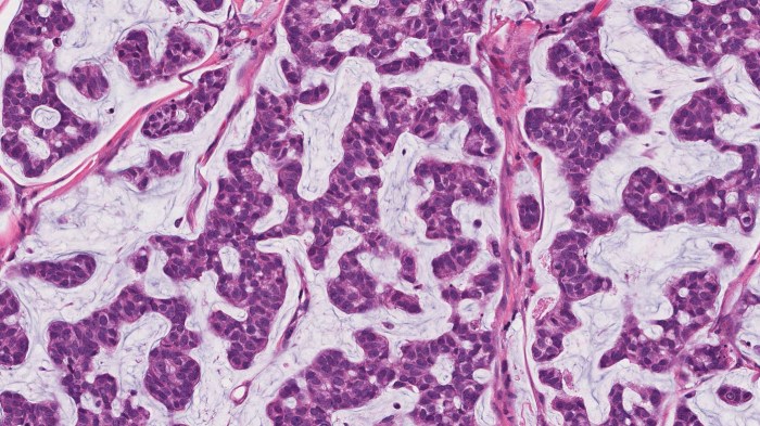 What is secreted by the highlighted cell