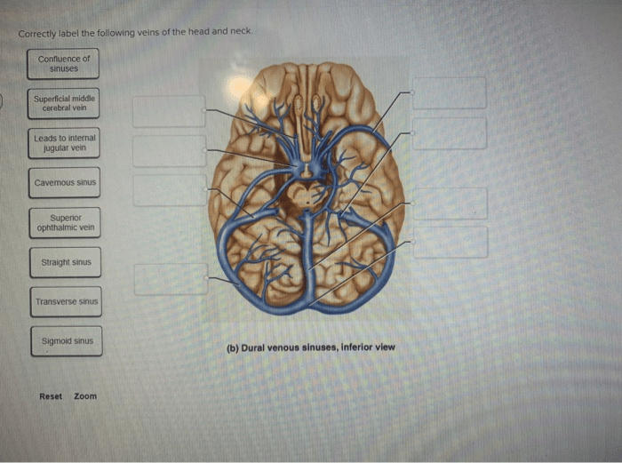 Head neck veins anatomy major system vertebral vessels artery blood brain cabeza quizlet circulatory arteries vessel medical physiology cerebral posterior